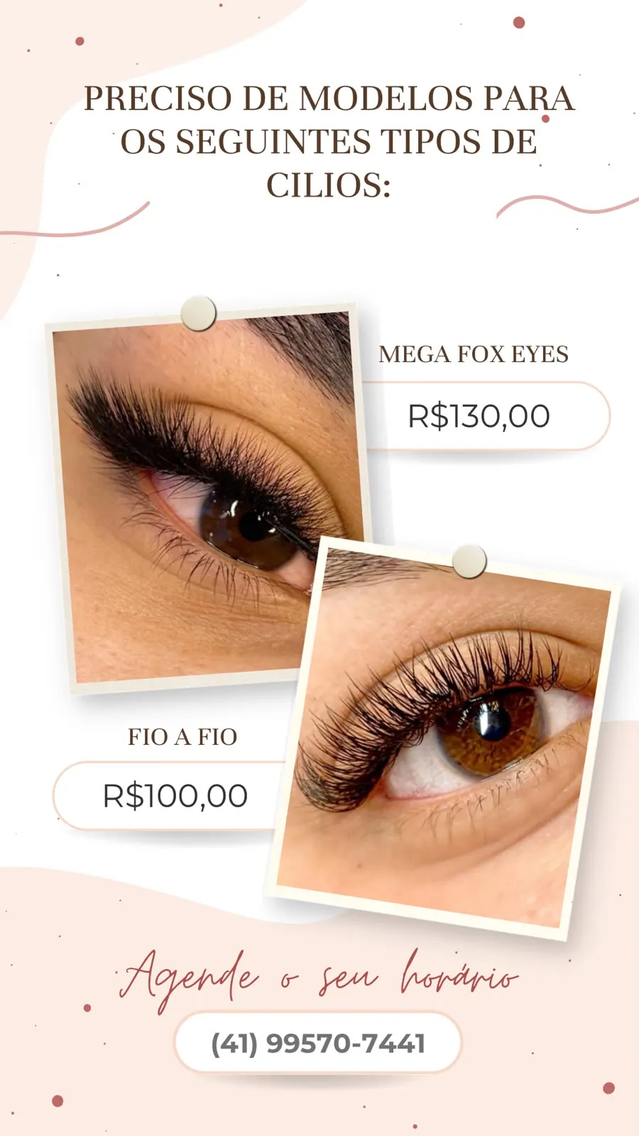 Aplicações Fox Eyes e Fio a Fio em diferentes olhos